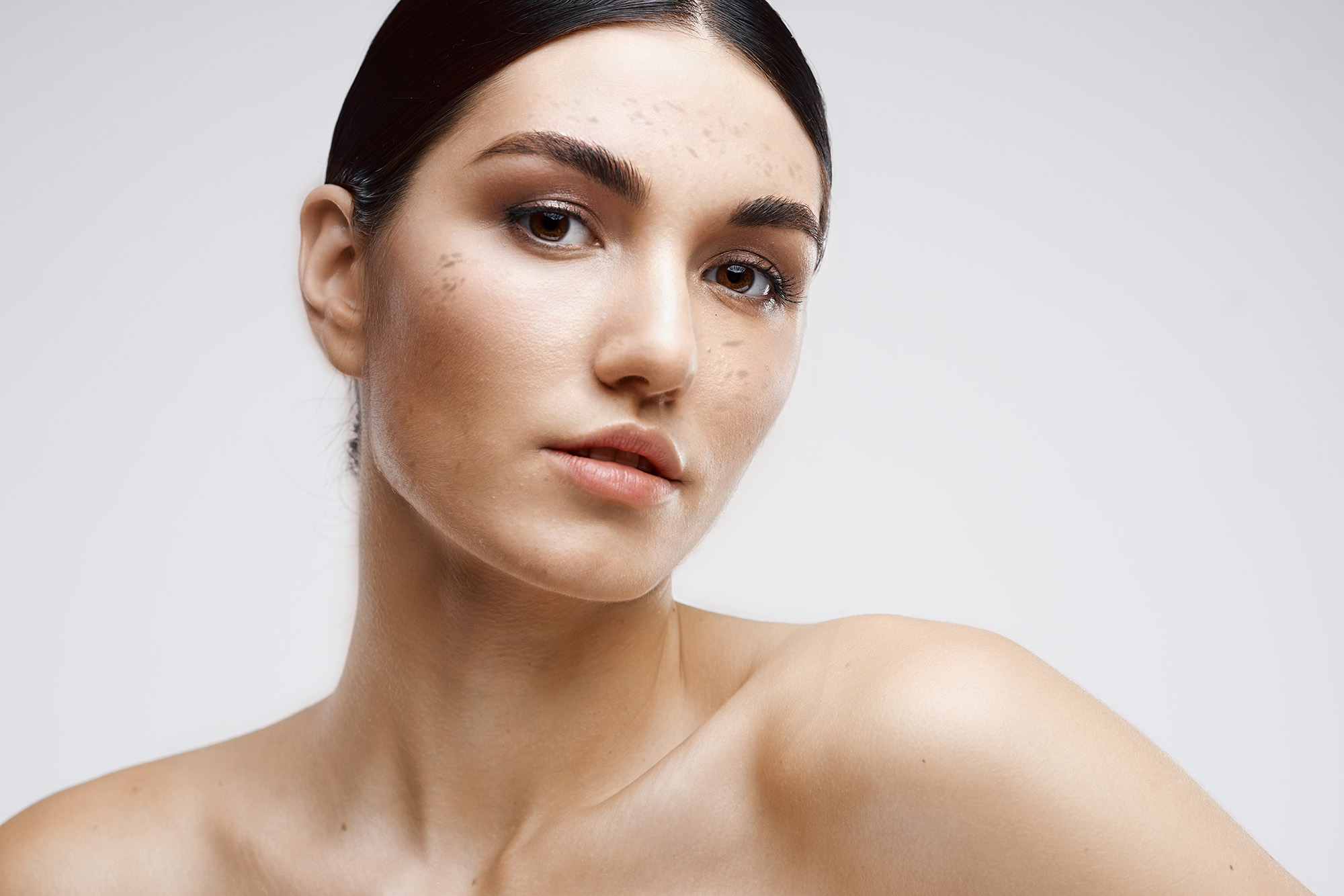 Excel V+ Redness Reduction