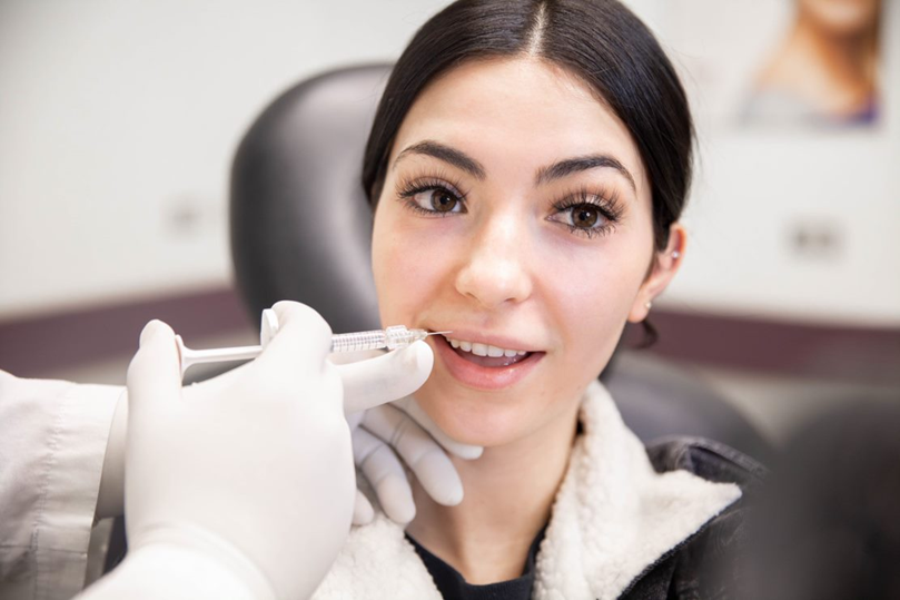 Lip Fillers