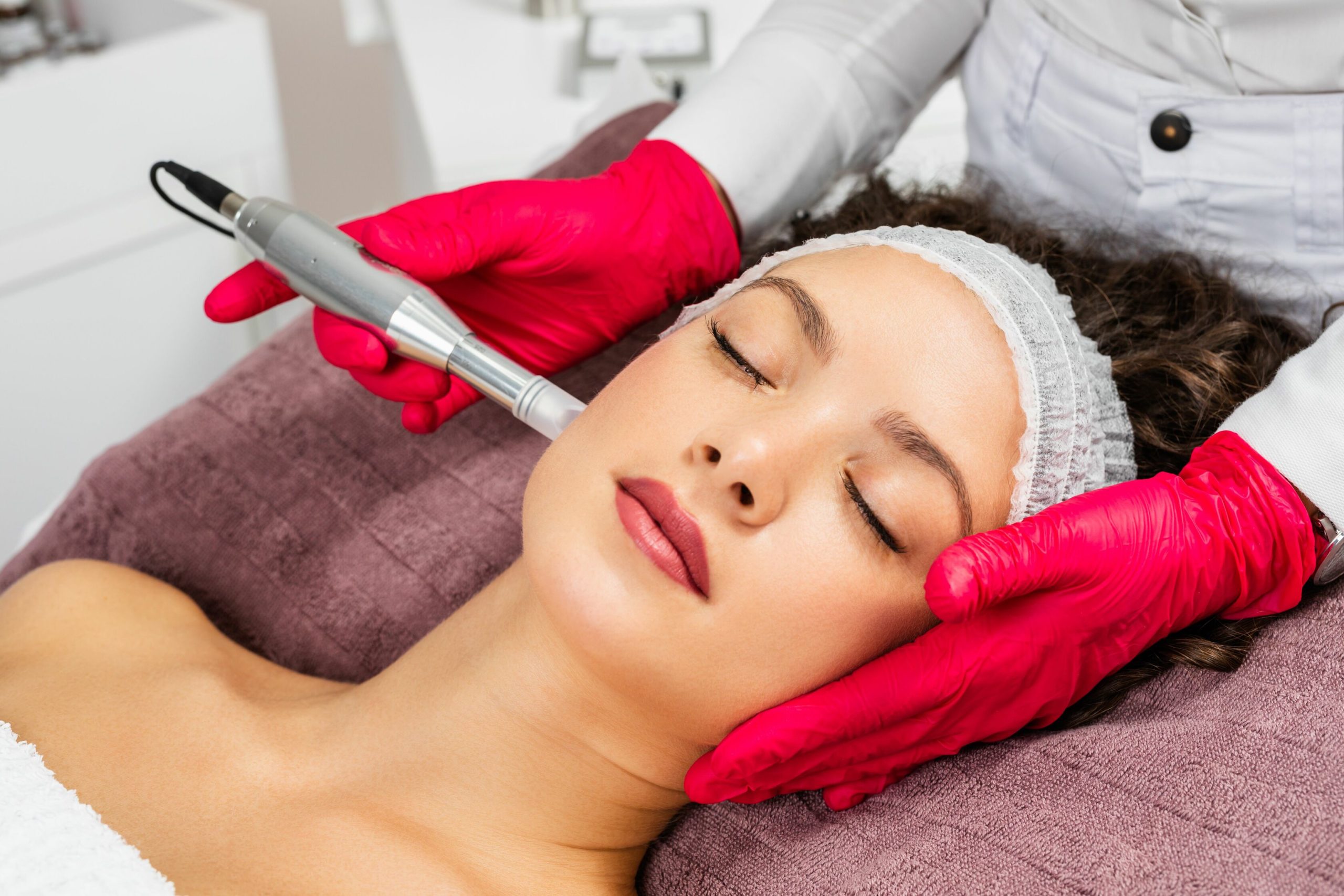 Micro-needling treatment for pores