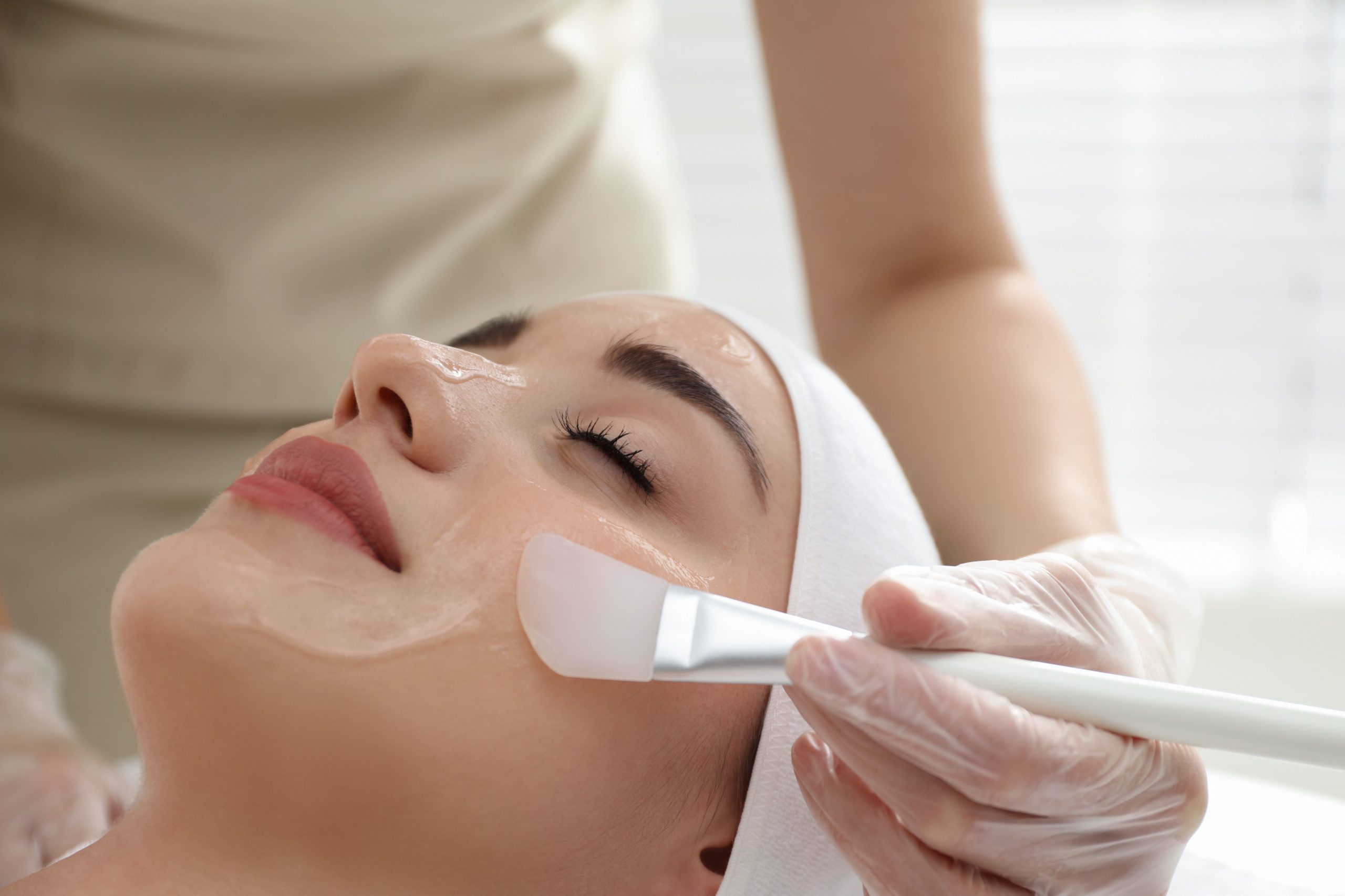 chemical peel for pores