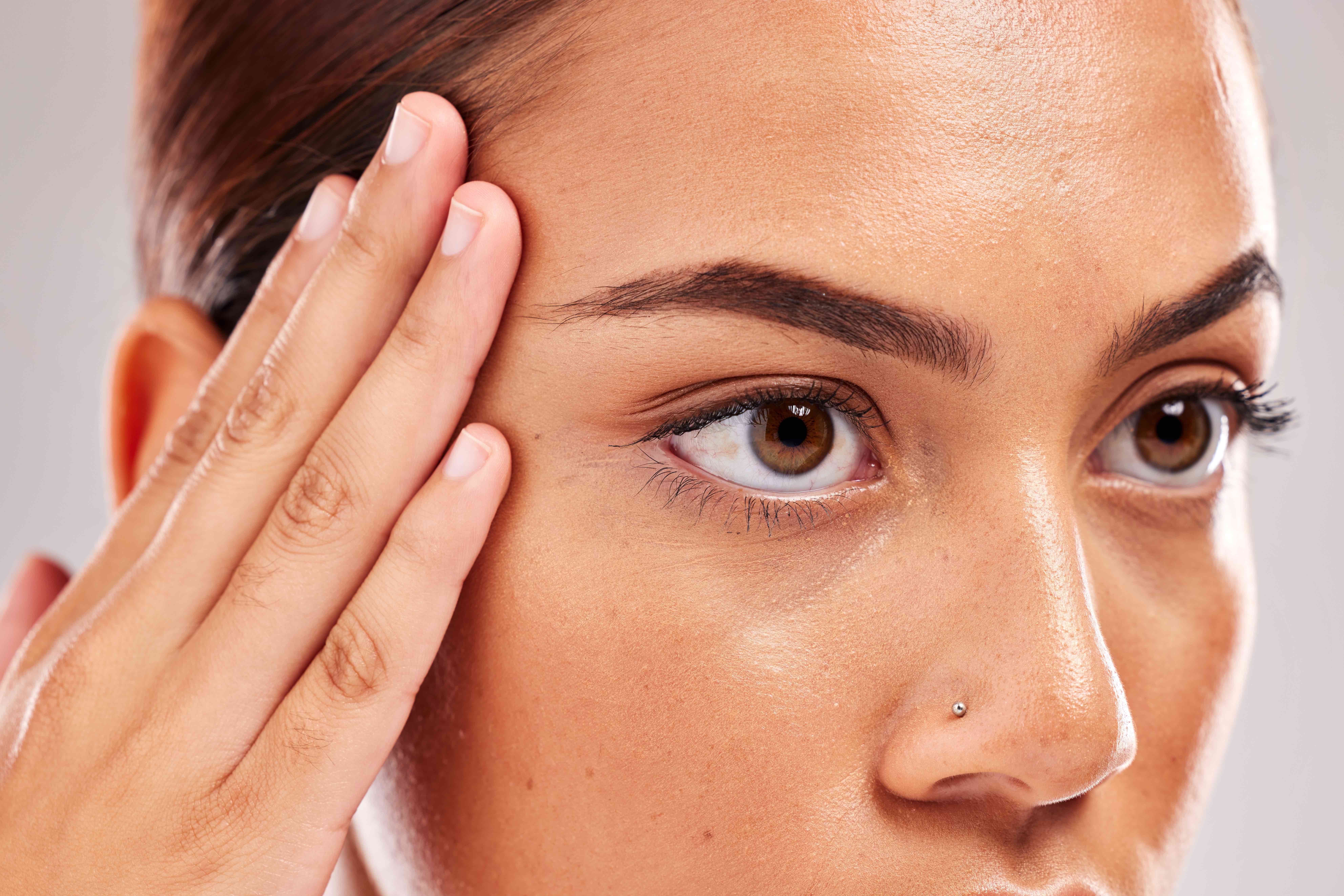 Brow Lift