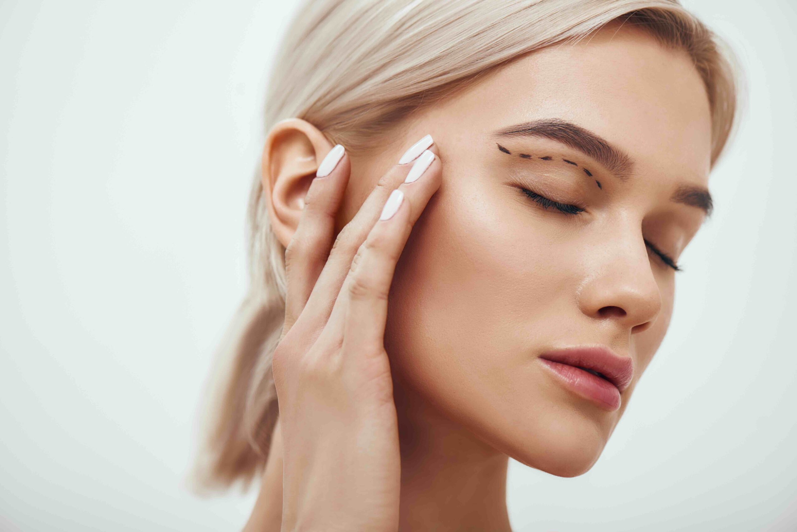 Blepharoplasty