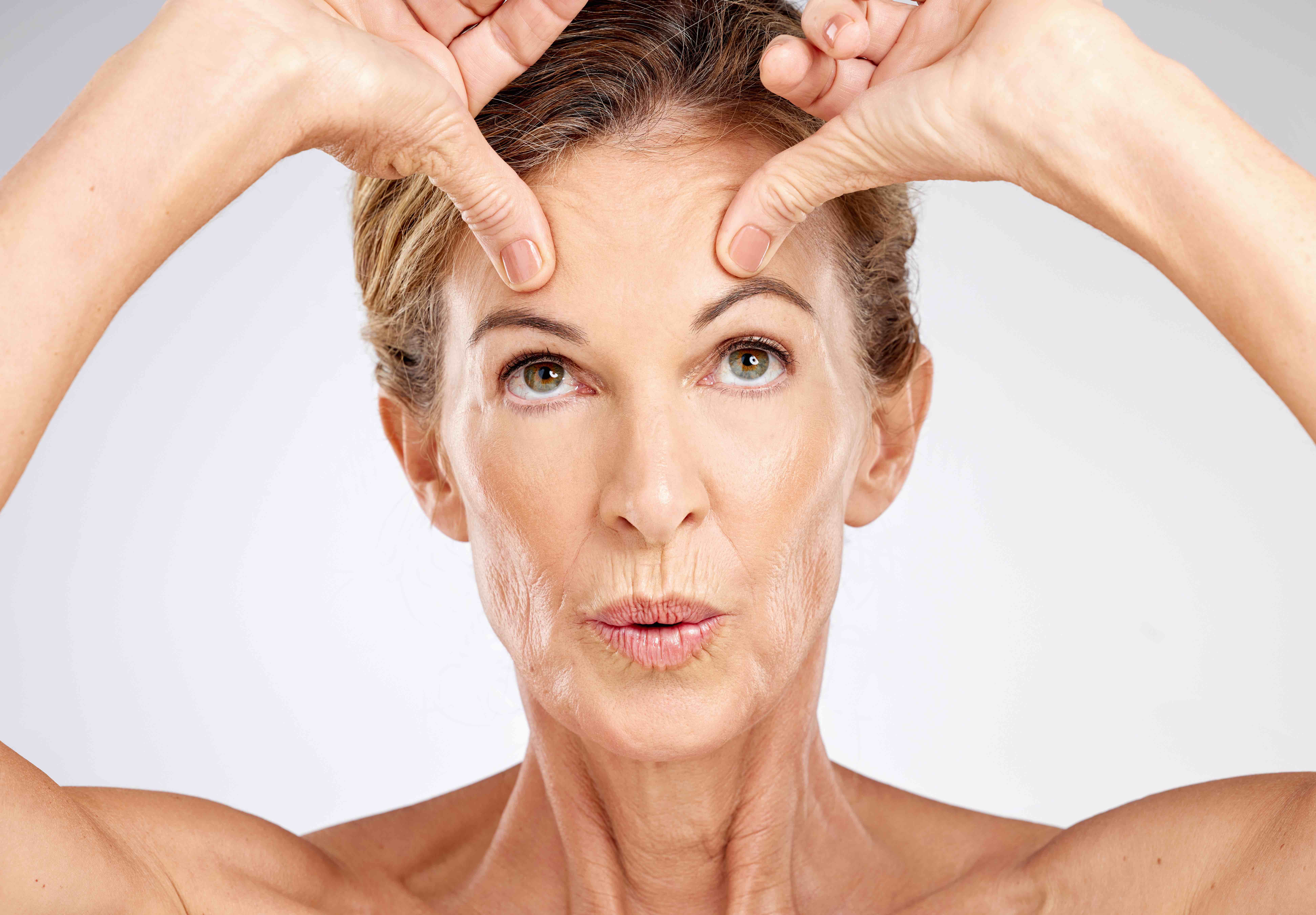 Rhytidectomy (Facelift)