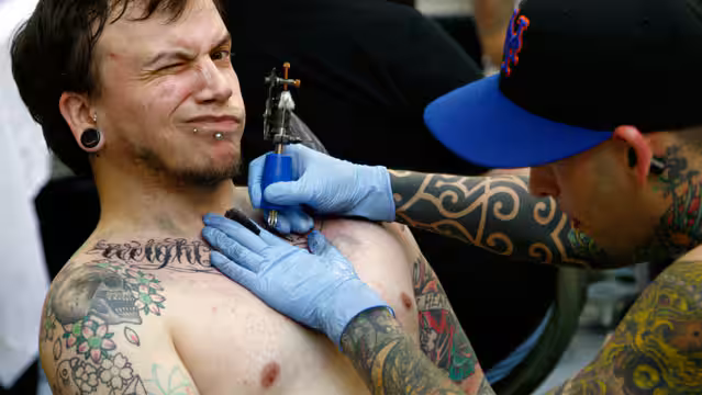 Pico Tattoo Removal results