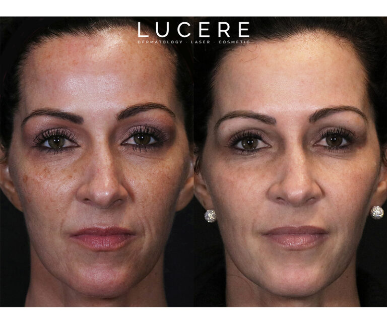 full face transformation results before and after
